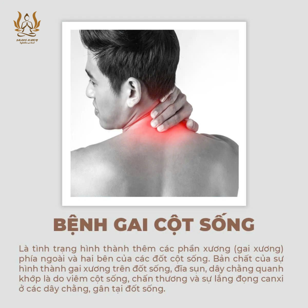 Gai Cột Sống & Đau Thần Kinh Tọa: Hiểu Đúng Để Trị Liệu Tận Gốc (Không Xâm Lấn) 2026