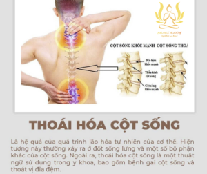 Thoái Hóa Đĩa Đệm